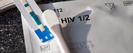 verschiedene HIV-Tests